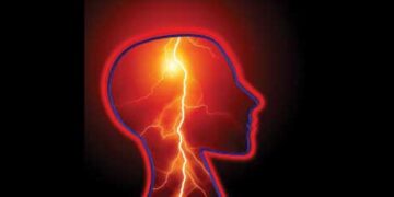 epilepsy patients