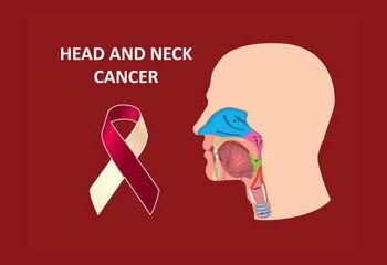 neck-cancer