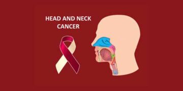 neck-cancer