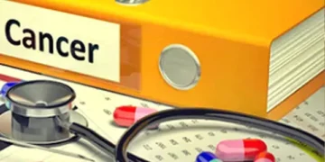 Prostate cancer raises risk of Alzheimer’s