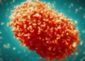 Mpox case