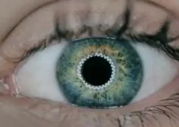 eye