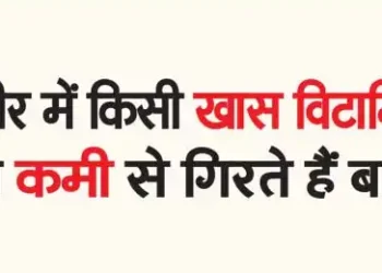 Hair falls due to deficiency of any particular vitamin in the body.