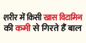 Hair falls due to deficiency of any particular vitamin in the body.