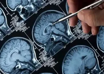 NHS blocks drug for Alzheimer's