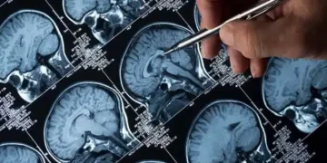 NHS blocks drug for Alzheimer's
