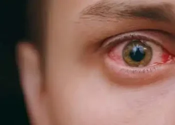 eye