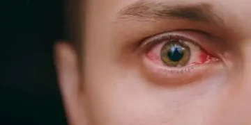 eye