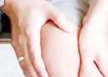 Bones become hollow in osteoporosis