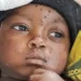 UN nods first mpox vaccine for children