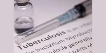 Centre to launch 100-day TB elimination campaign