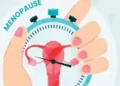 What is surgical menopause?