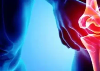 Osteoarthritis