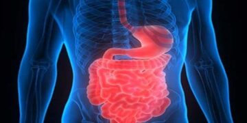 Researchers find mechanisms that may lead to inflammatory bowel disease