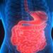 Researchers find mechanisms that may lead to inflammatory bowel disease