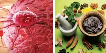 Clinical trial of Ayurvedic medicine for cancer successful