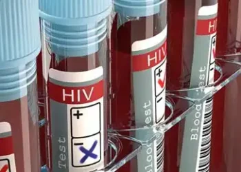 hiv