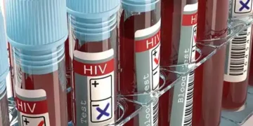 hiv