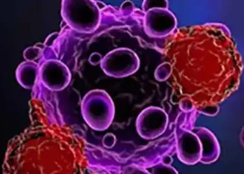 Stem cell therapy safe, and effective in treating Parkinson's disease