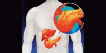 The liver of even younger people is becoming fatty