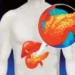 The liver of even younger people is becoming fatty
