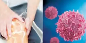 Does Vitamin D deficiency cause cancer?