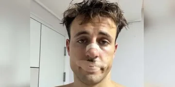 Fad of mouth taping during sleep may pose serious risks