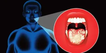 90 percent of oral cancer cases in India are due to tobacco