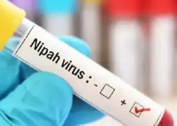 Nipah virus