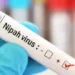 Nipah virus