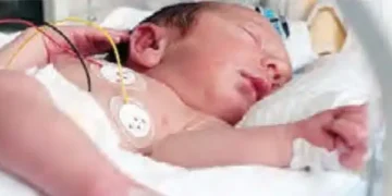 Due to air pollution, every 8th child is born prematurely