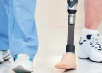 Low-cost carbon fibre foot prosthesis unveiled