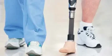 Low-cost carbon fibre foot prosthesis unveiled