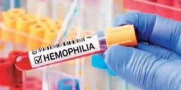 hemophilia