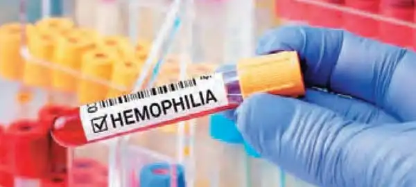 hemophilia