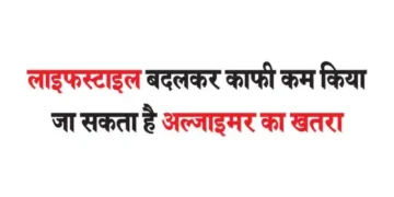 The risk of Alzheimer's can be reduced significantly by changing lifestyle