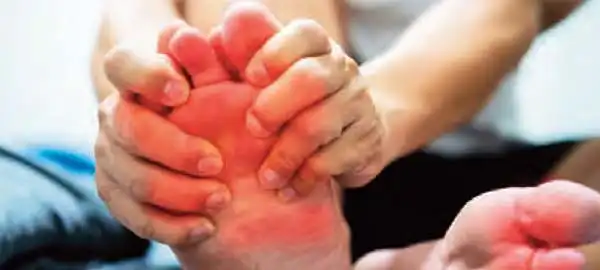 If uric acid increases then there is a risk of gout