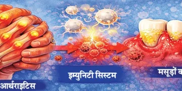 दांतों की बीमारी से हो सकता है गठिया!