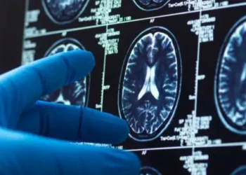Dementia Testing