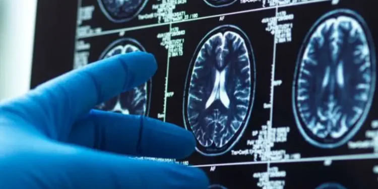 Dementia Testing