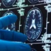 Dementia Testing